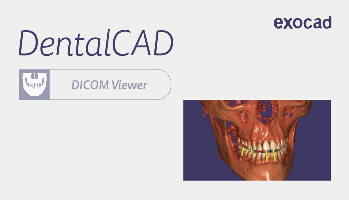 Module DICOM Viewer Exocad DentalCAD – DAOS DENTAL SAS