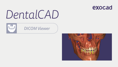 Module DICOM Viewer Exocad DentalCAD