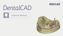 Charger l&#39;image dans la galerie, Implant Module Exocad DentalCAD