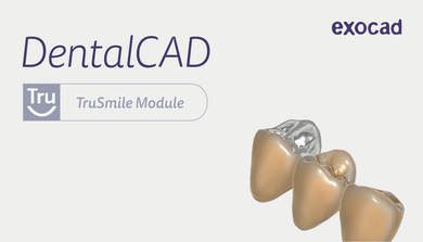 Module TruSmile Exocad DentalCAD