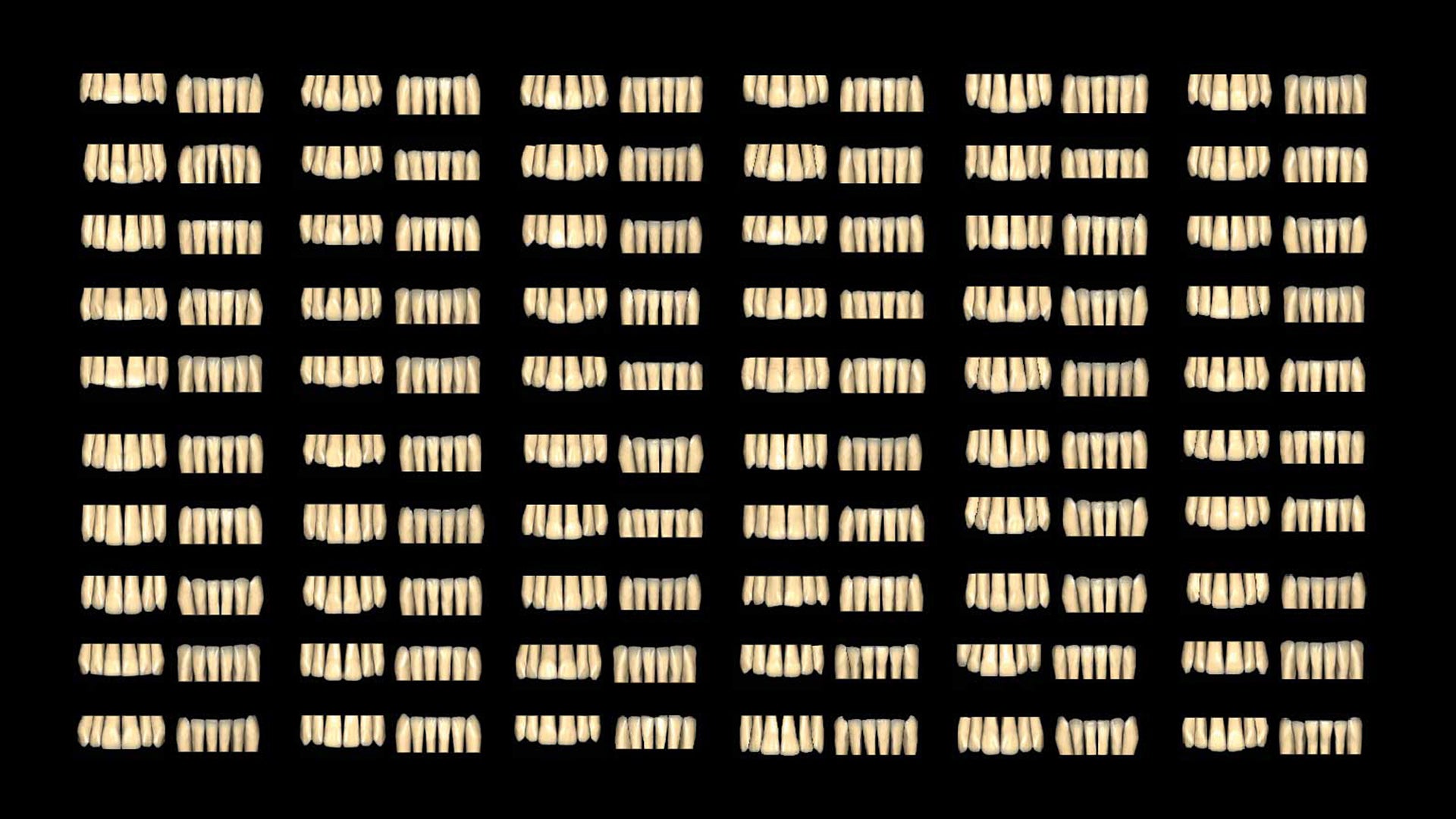 Module Tooth library Exocad